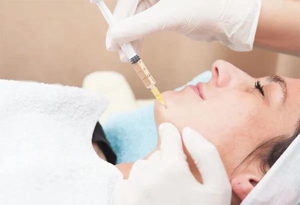 Độn cằm rồi có tiêm filler được không? Chuyên gia chia sẻ