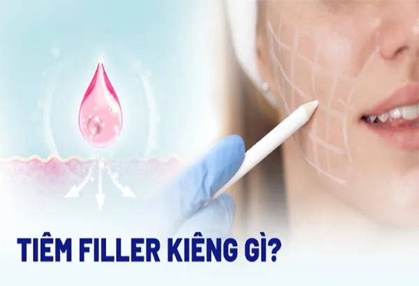 Mới tiêm filler cằm nên kiêng gì? Chuyên gia chia sẻ