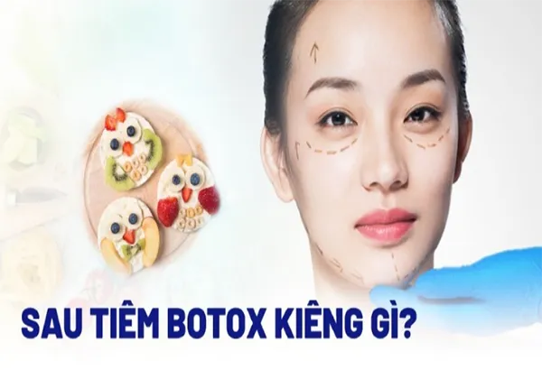 Tiêm botox kiêng gì? Những lưu ý sau khi tiêm