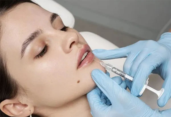 Tiêm filler cằm có nguy hiểm không? Những điều cần biết