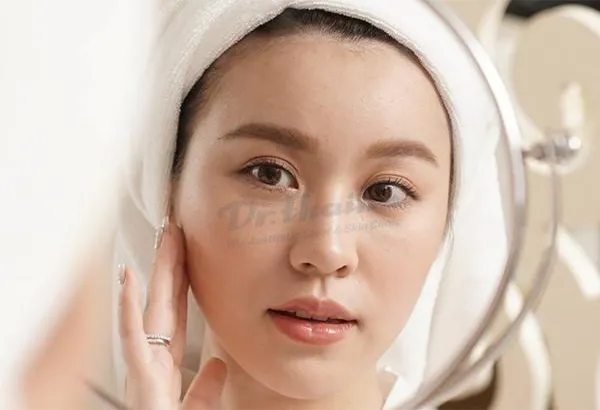 Tiêm filler có bị chảy xệ không? Chuyên gia chia sẻ