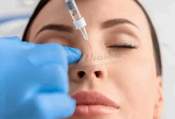 Tiêm filler hỏng? Nguyên nhân và cách khắc phục