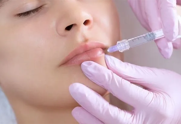 Top dáng môi tiêm filler đẹp được yêu thích hiện nay