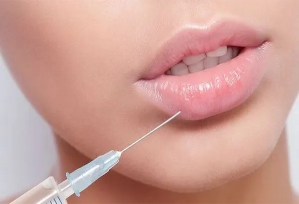 Top dáng môi tiêm filler đẹp được yêu thích hiện nay